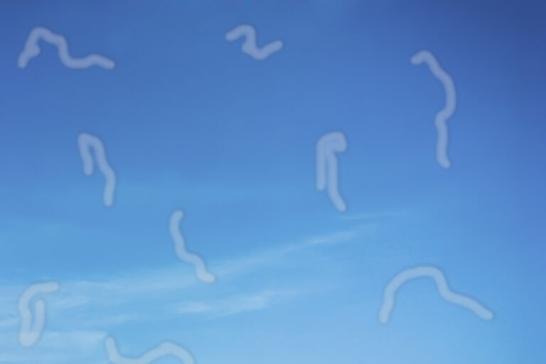 Μυγάκια στα Μάτια: Συχνές Ανησυχίες και Πότε να Ζητήσετε Βοήθεια