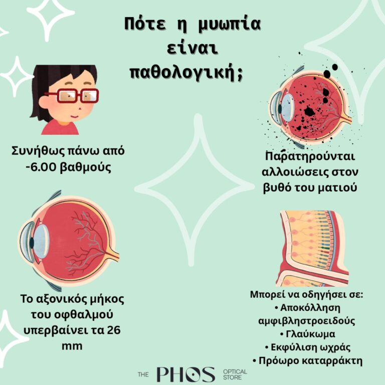 Τι είναι η παθολογική μυωπία;